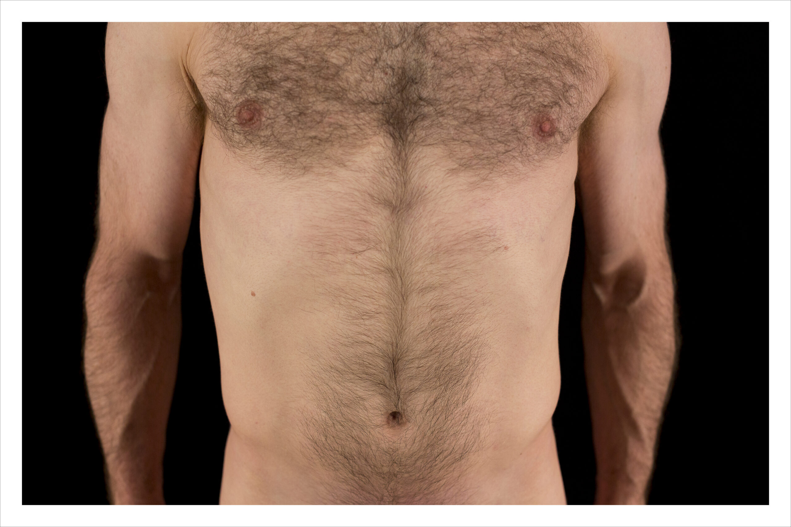 The Parts Featuring James Jeske #0820